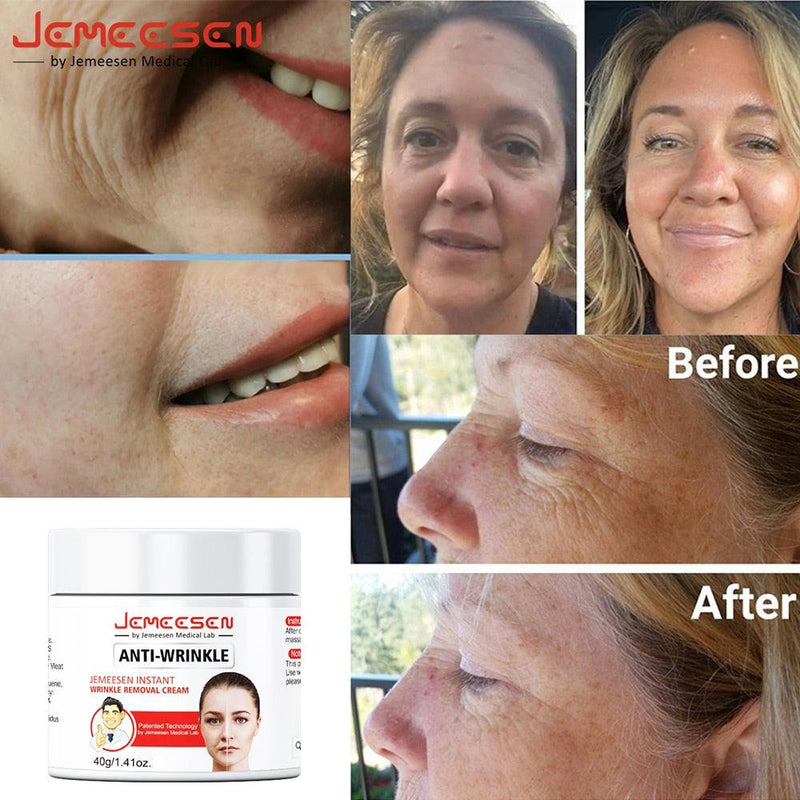 Jemeesen Retinol Lifting Creme Refirmante Remove Rugas Antienvelhecimento Desvanece Linhas Finas Clareamento Facial Ilumina a Pele Beleza Cuidados com a Saúde - Petra Zoully